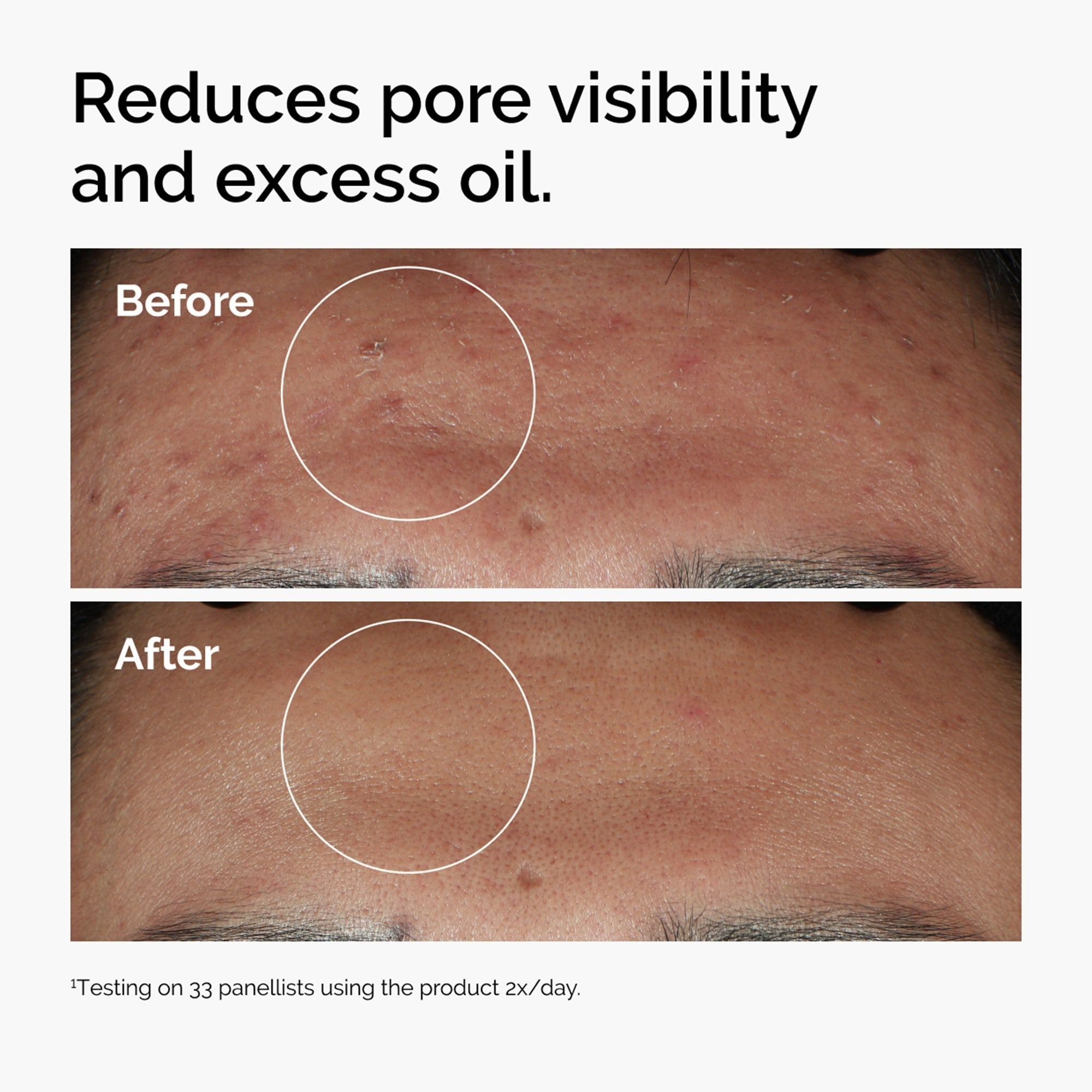 The Ordinary Niacinamide 10% + Zinc 1% – Sérum anti-imperfections pour réduire le sébum et les boutons – Image 2